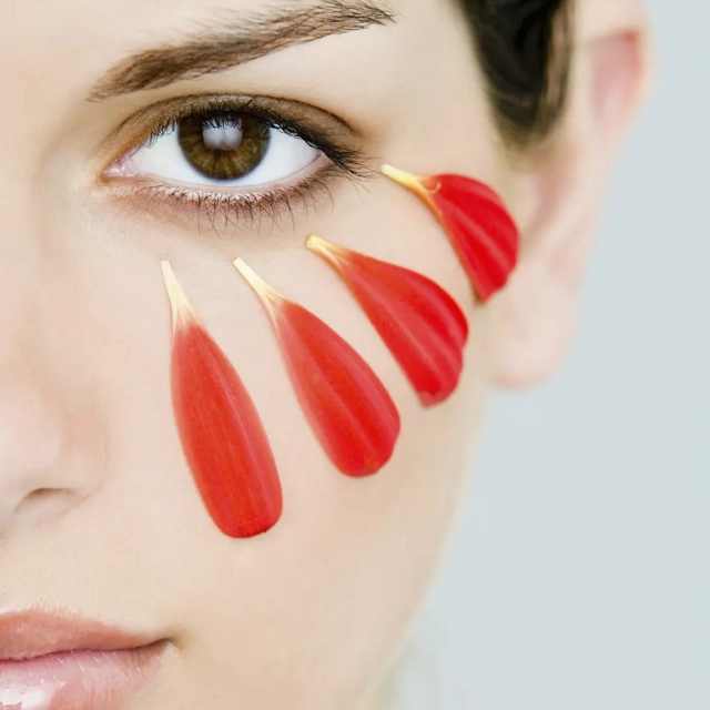 Traiter les rougeurs et la couperose