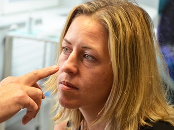 La blépharoplastie médicale par Plexr
